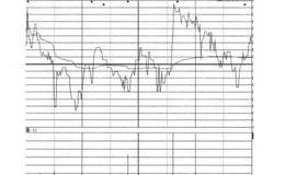 分时走势第3招：回调、反弹幅度的概述解读