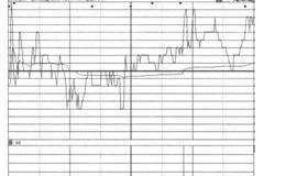 分时走势第10招：解析冲击波形出货的案例详解