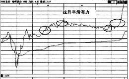 如何及时跟进起涨型股票