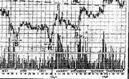 对称倾向指什么