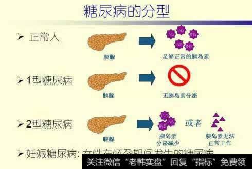 糖尿病的分型