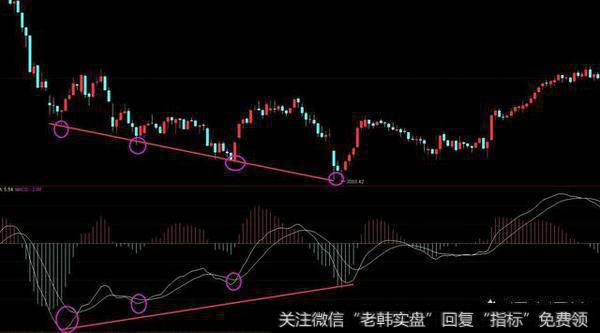 股市最基本的MACD选股技巧有哪几种？