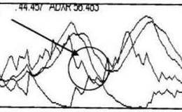KDJ+DMI+MA指标经典回调洗盘组合