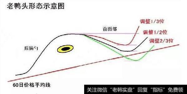 老鸭头形态是什么？遇到老鸭头形态应该怎么操作？