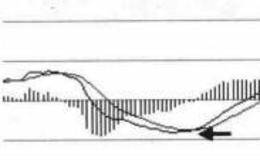 大智慧技术面分析：平滑异同平<em>均线用法</em>