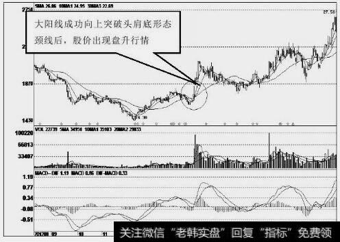 爱尔眼科(300015)