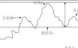 顶部趋势是什么？如何理解顶部形态形成的本质规律？