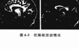 伏隔核和投资者的预期有哪些联系？动物脑神经实验对于投资预期有哪些新的认知？