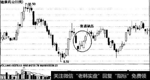 普通缺口