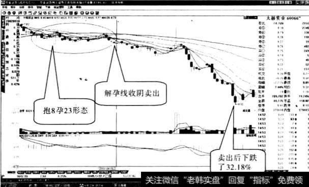 操作“前抱后孕线”形态时应注意什么2