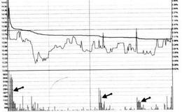 “对走势无影响的短促大笔对倒单”指的是什么形态？
