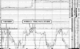 “MSD+MACD”组合盘口实战案例精解