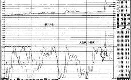 “MSD+KDJ”组合盘口实战案例精解