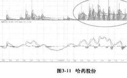 青岛海尔股票实例分析？哈药股份股票分析？
