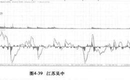 <em>浙江东方</em>(600120) 和江苏吴中(600200)的股票分析？实例分析？