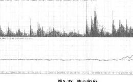 股票下跌？股票下跌应该如何办？