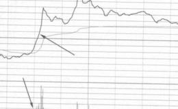<em>股票入门讲解</em>丨如何理解盘中疯狂对倒推高的操盘意图？