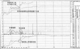 XDQD+矩形组合捕捉分时图启动点的战法精要