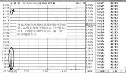 <em>涨停板选股法</em>：当天如何把握涨停板