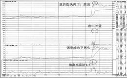 均价线之上的卖点