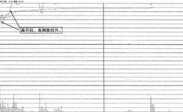 结合实战案例来对高开擒杀涨停进行分析