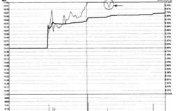 对“V”形裂口短期快速上涨的高点的解读